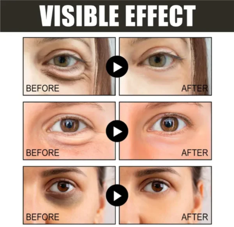 (🔥 Kupite 1, dobite 1 gratis🔥)Krema za oči s kofeinom - spiiyle