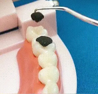 Komplet zobotrebcev iz nerjavečega jekla - spiiyle