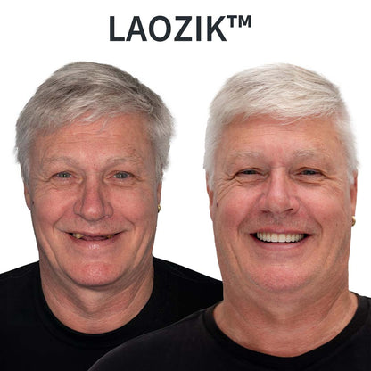 AdaptableFit Functional Dentures