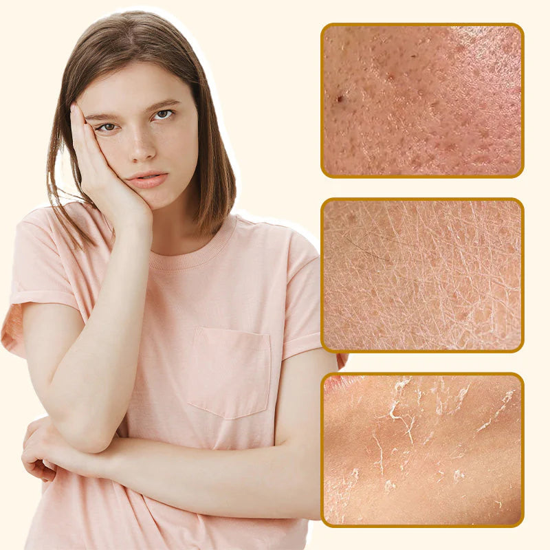 【🔥 Kupite 1 in dobite 1 gratis🔥】Organický hovädzí loj a medový balzam s hydratačnými vlastnosťami - spiiyle