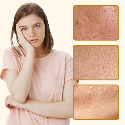 【🔥 Kupite 1 in dobite 1 gratis🔥】Organický hovädzí loj a medový balzam s hydratačnými vlastnosťami - spiiyle